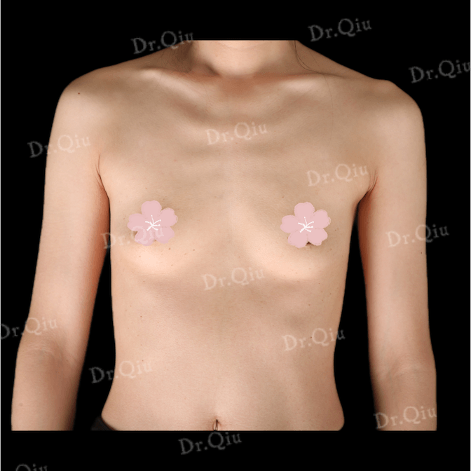 Case 1 - Photo 1