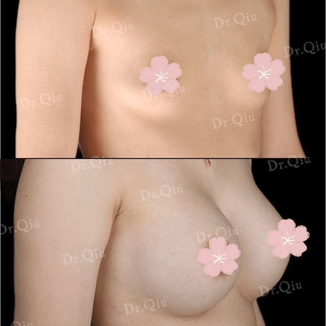 Case 1 - Photo 2