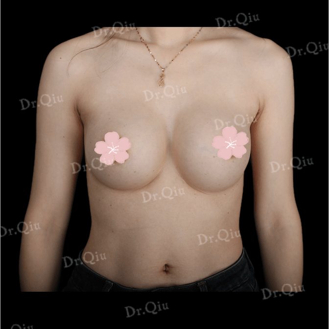 Case 1 - Photo 3