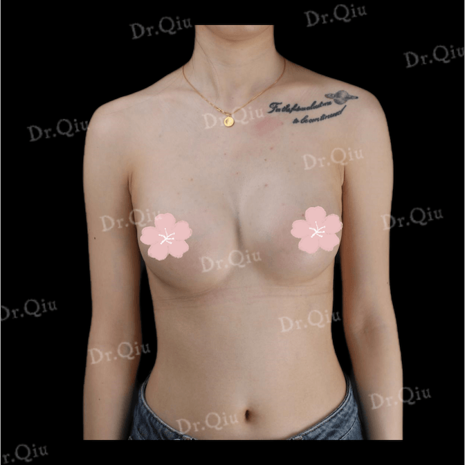 Case 2 - Photo 3