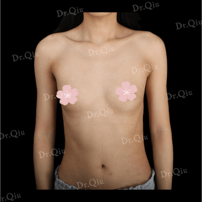 Case 4 - Photo 1