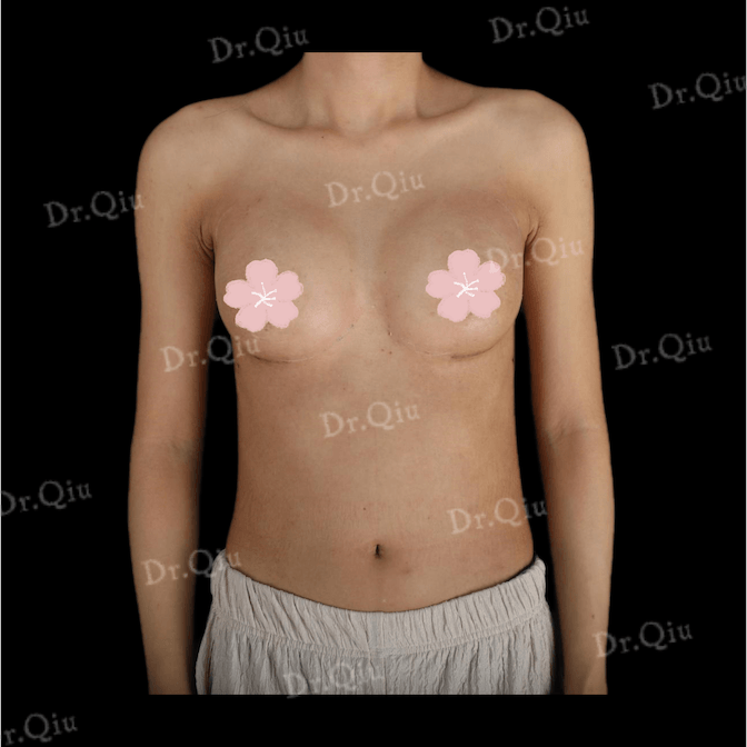 Case 4 - Photo 2