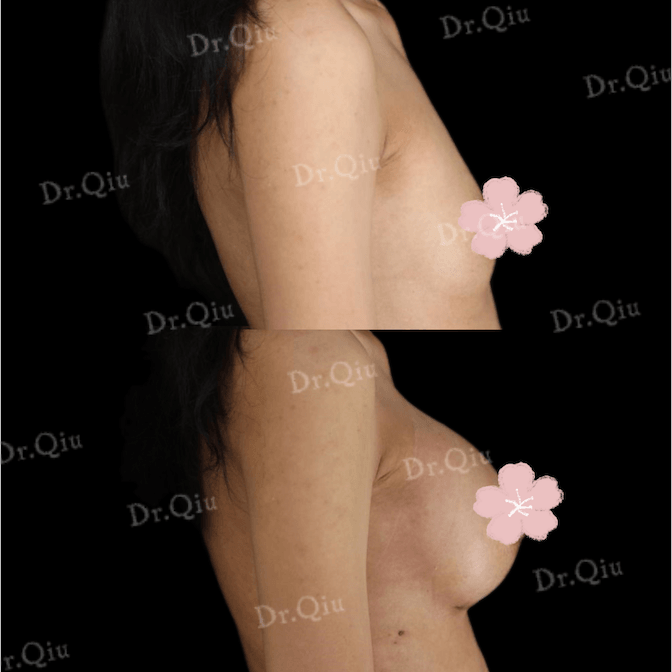 Case 4 - Photo 3