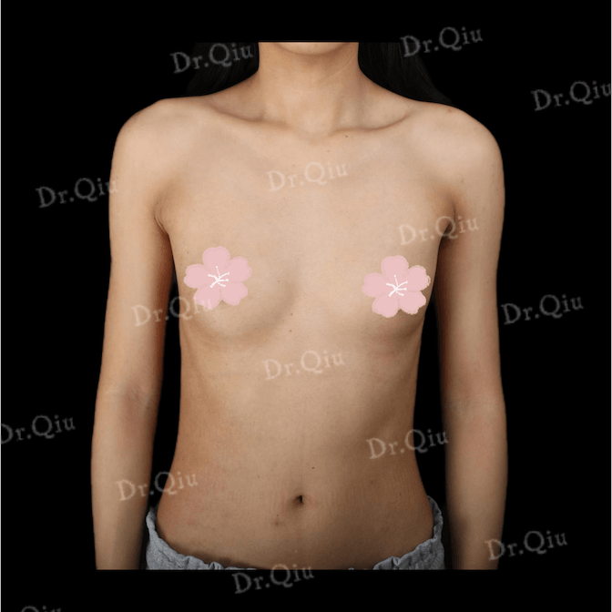 Case 5 - Photo 1