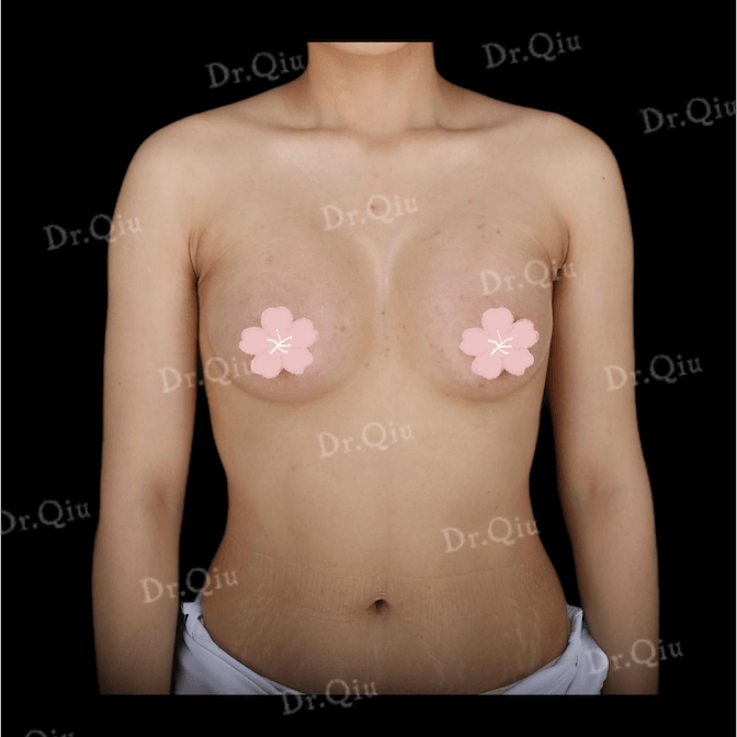 Case 5 - Photo 2