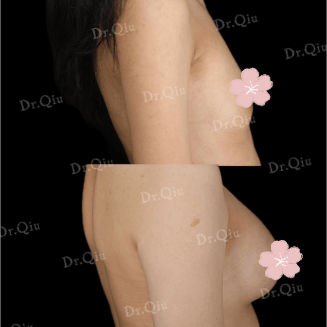 Case 5 - Photo 3