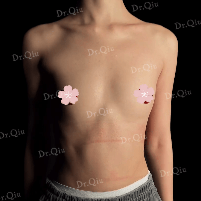 Case 6 - Photo 1