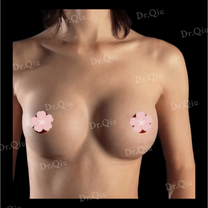 Case 6 - Photo 2