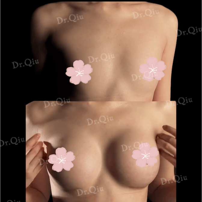 Case 6 - Photo 3
